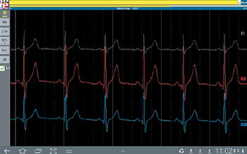 Elektor Android Cardioscoop (1)
				Deel 1